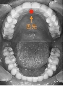 舌の定位置は上