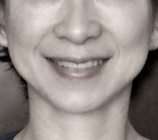 ”ほうれい線”は”ほほえみ線” 考え方しだい