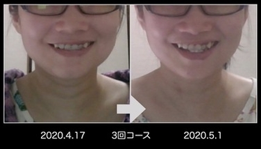 オンラインレッスン（before-after）