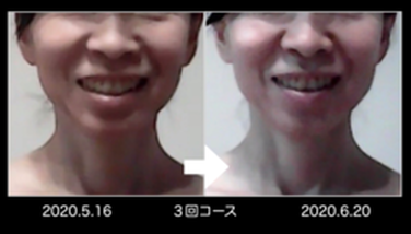 オンラインレッスン（before-after）