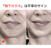 「不幸そう」は梅干しのタネ出現中