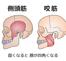 側頭筋・咬筋