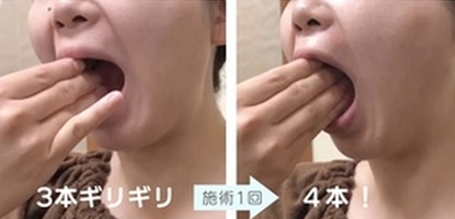 口の開け方　食いしばり　口はタテに2段階に開ける
