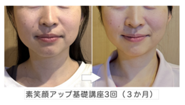 美表情塾　素笑顔アップ連毒講座　フェイスライン　