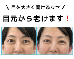 美表情塾　目の開け方に注意　口角挙筋　ほほで笑う