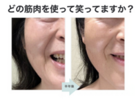 どこの筋肉を使って笑っていますか？