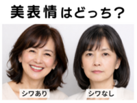 にっこり笑えば「ほほえみ線」！