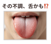 舌は筋肉！その不調、舌かも!?