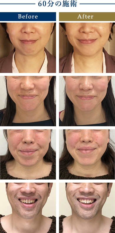 施術のbefore-after